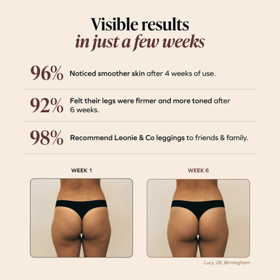 3D Anti-Cellulite Leggings