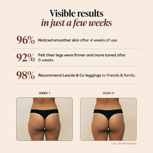 3D Anti-Cellulite Leggings